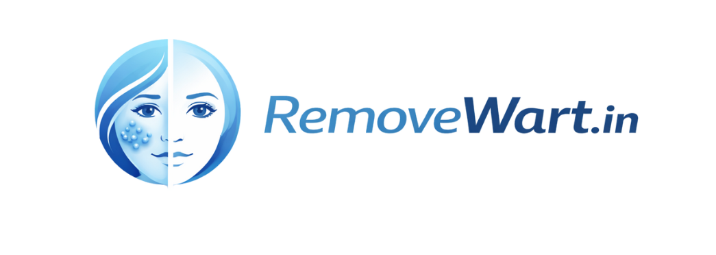 Remove wart